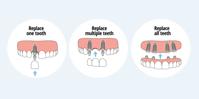 How to Compare Multiple Dental Plan Options Side by Side